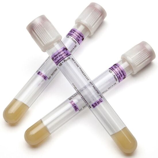 Vacutainer Pearl White Blood Collection Tube with K2EDTA Polymer gel 13 x 5 mL 5 mL 100box