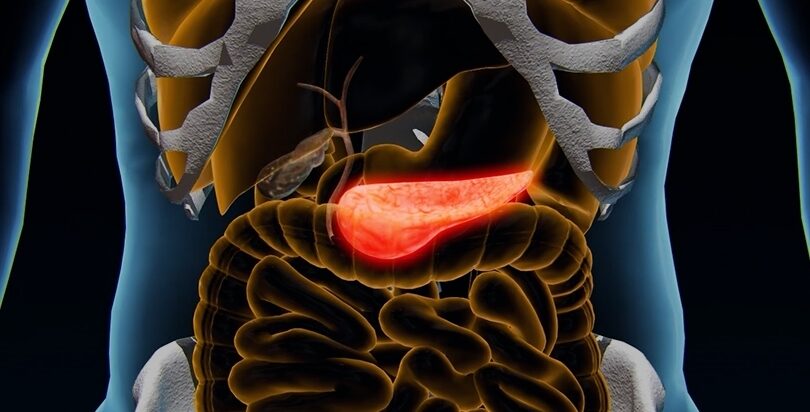 Industry News: Study Suggests Pancreatic Cancer Patient Survival Doubled with High-Dose Vitamin C